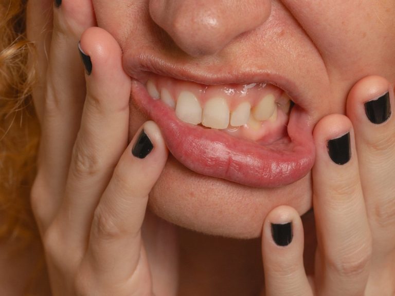 Eine Person hält sich das Gesicht und zeigt Anzeichen von Schmerz oder Unbehagen.